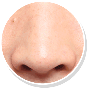 화살코 전후사진