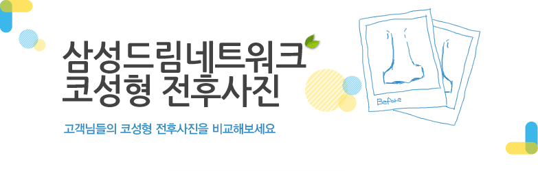 코성형 전후사진