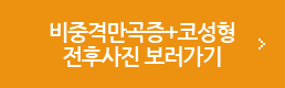 비중격만곡증+코성형 전후사진 보러가기