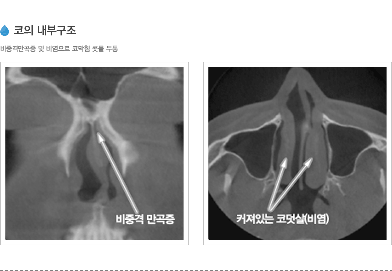 코의 내부구조