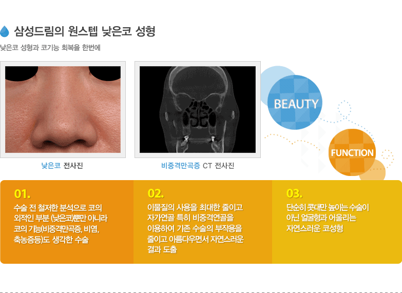삼성드림의 원스텝 낮은코 성형
