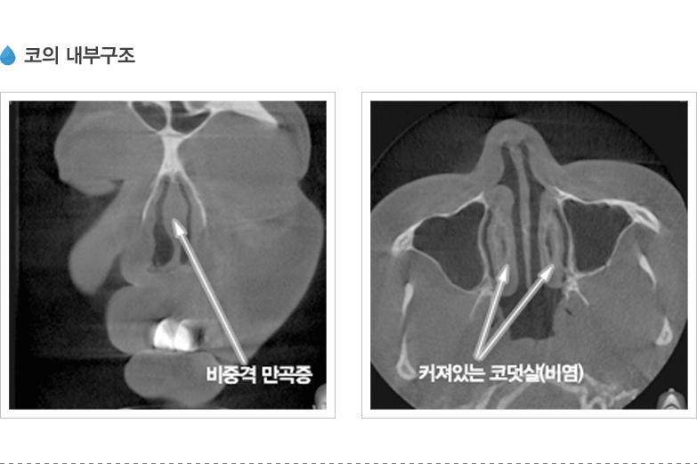 코의 내부구조