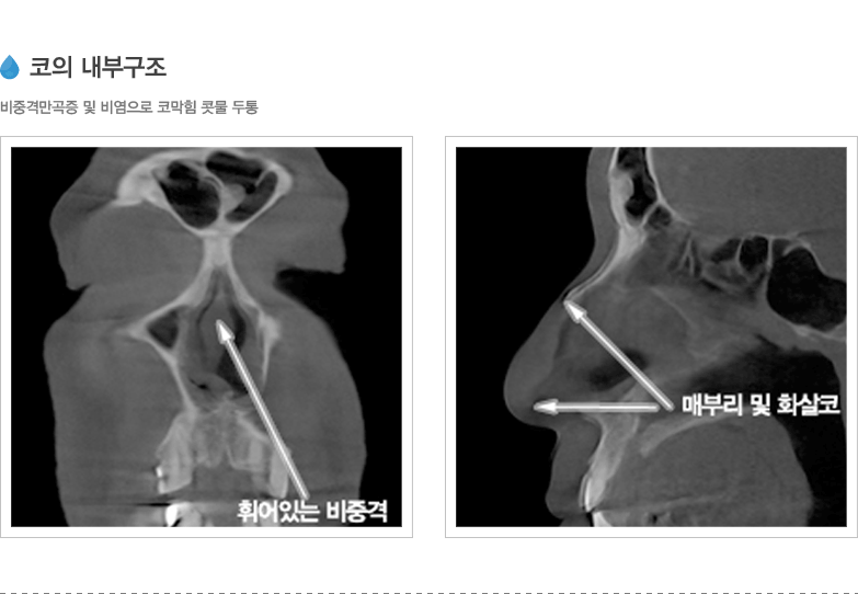 코의 내부구조