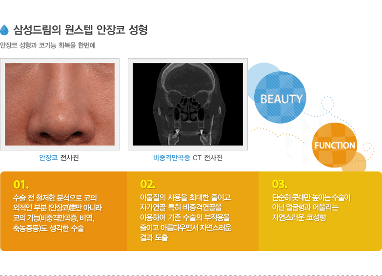 삼성드림의 원스텝 안장코 성형