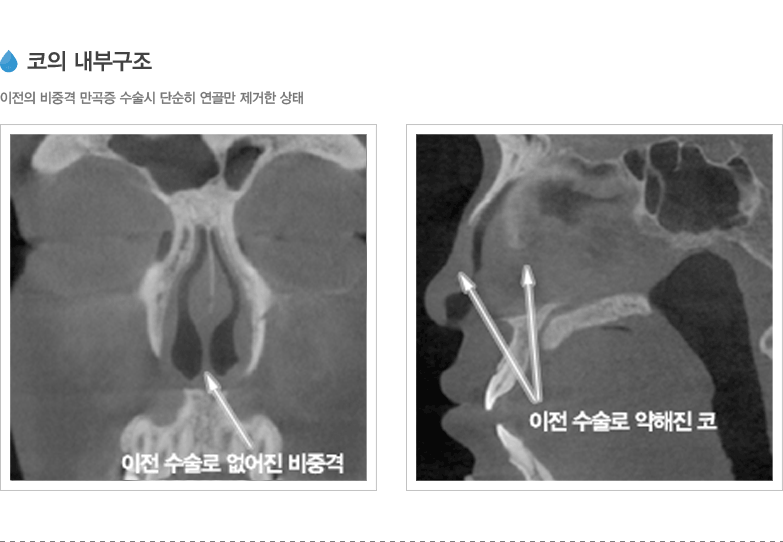 코의 내부구조