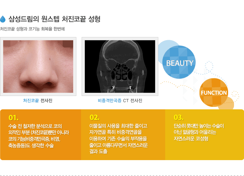 삼성드림의 원스텝 처진코끝 성형