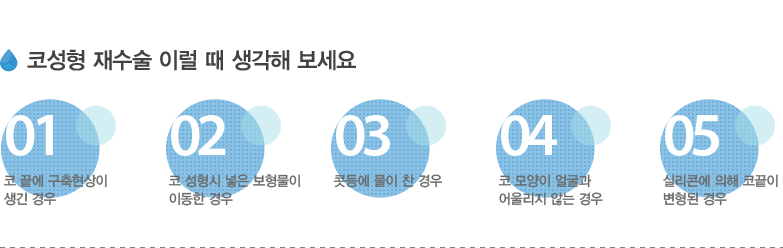 코성형 재수술 이럴 때 생각해 보세요