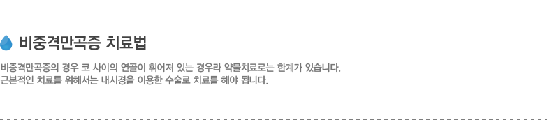 비중격만곡증 치료법