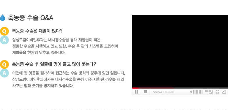 축농증 수술 Q&A