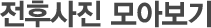 수술후기 모아보기